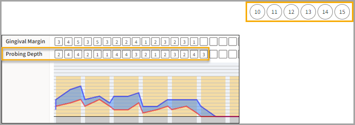 Perio exam with yellow highlight box around the Probing Depth and corresponding number entries.